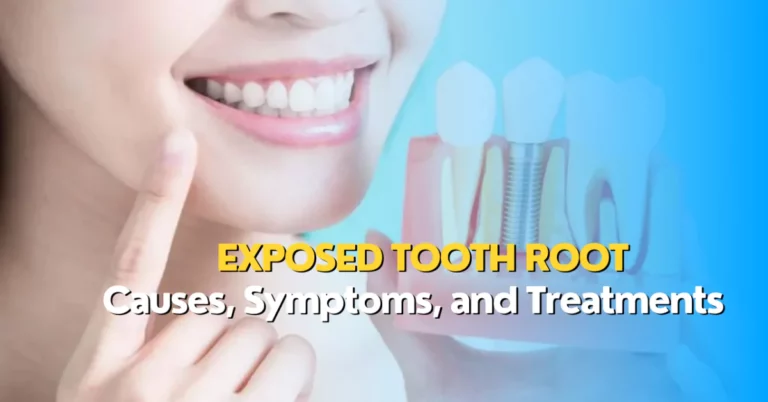 Exposed Tooth Root – Causes, Symptoms, and Treatments