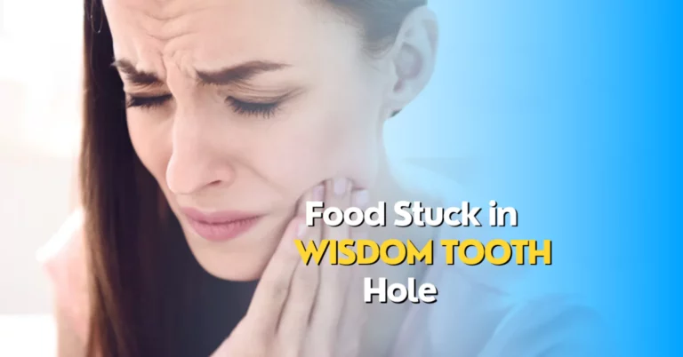 Food Stuck in Wisdom Tooth Hole: Causes, Risks and Solutions