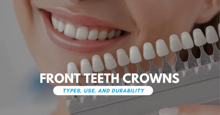 Front Teeth Crowns: Types, Use, and Durability