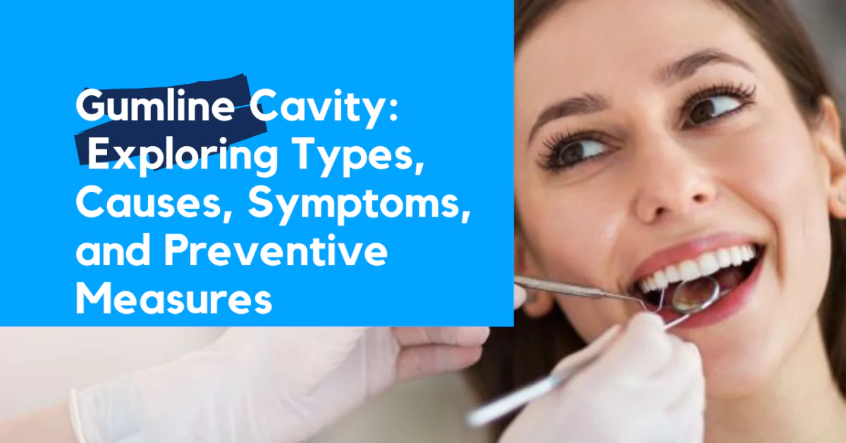 Gumline Cavity
