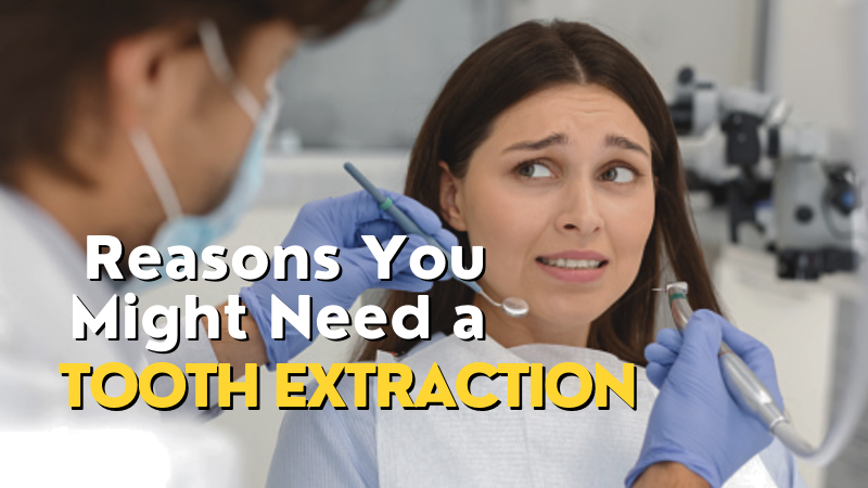 Reasons You Might Need a Tooth Extraction