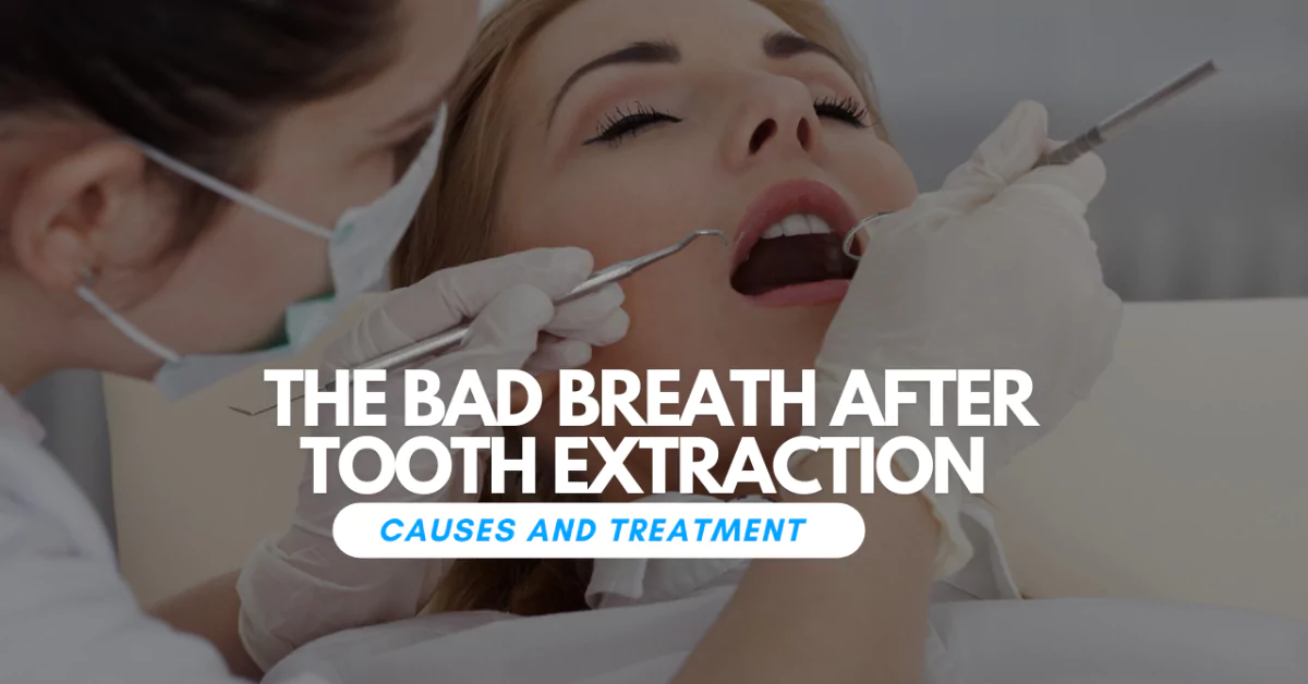 The Bad Breath After Tooth Extraction