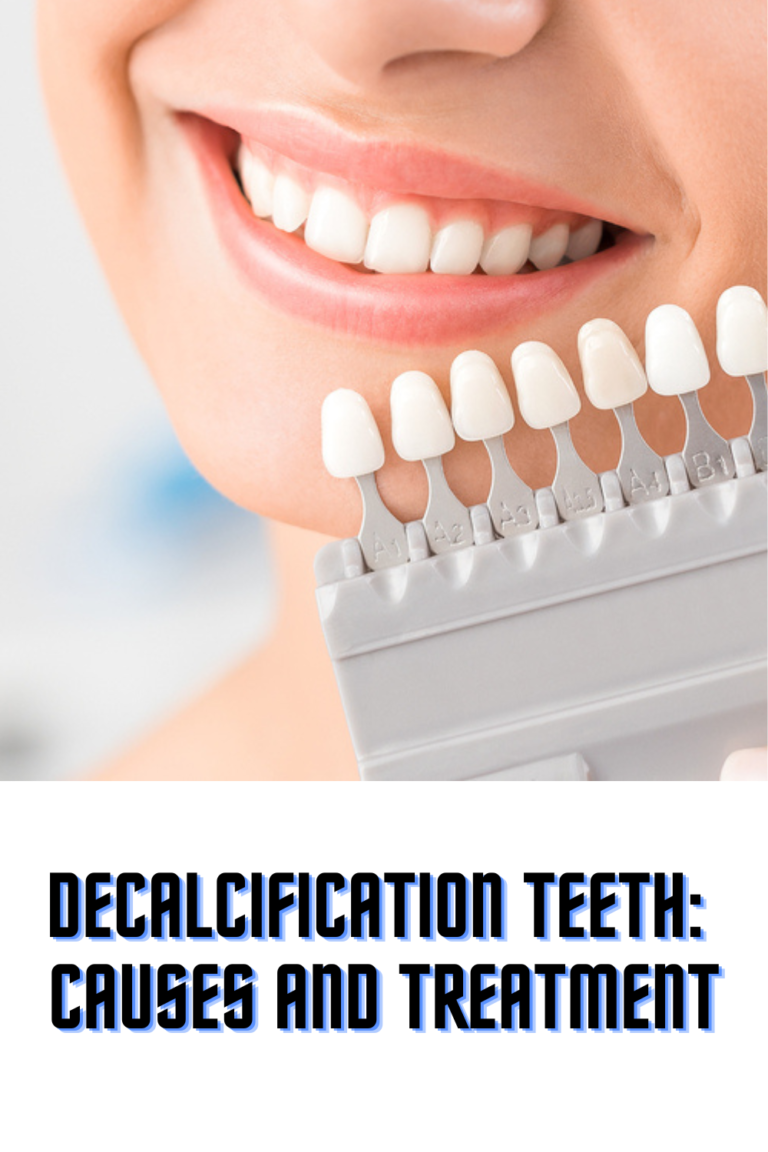 Decalcification Teeth: Causes and Treatment